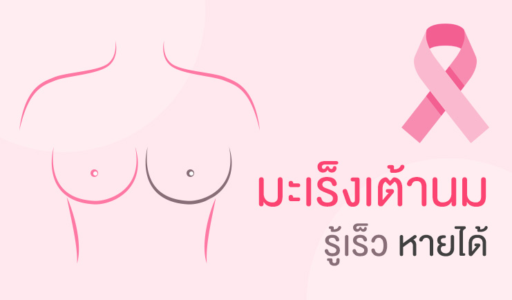 มะเร็งเต้านม