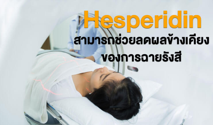 Hesperidin สามารถช่วยลดผลข้างเคียงของการฉายรังสี